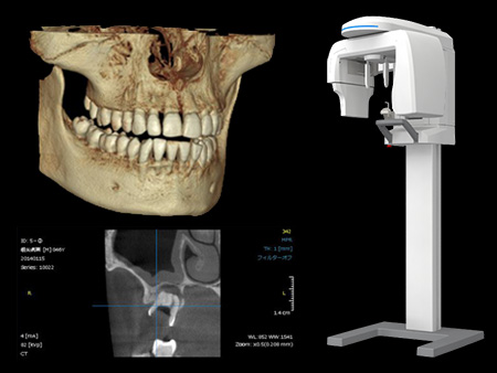 歯科用3D装置(歯科用CT)